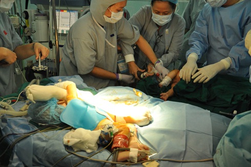 Các bác sĩ Bệnh viện Nhi Đồng 2 mổ tách cặp song sinh gái 4 tháng tuổi cuối năm 2012. Ảnh: Thiên Chương.