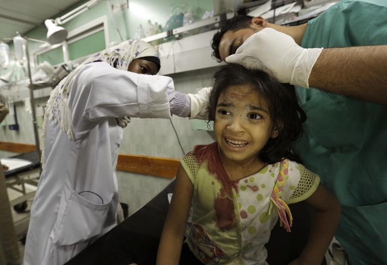 Một bé gái đang được điều trị tại bệnh viện Kamal Edwan ở Beit Lahia, Dải Gaza. Cô bé là nạn nhân của vũ nã pháo vào trường học LHQ của Israel