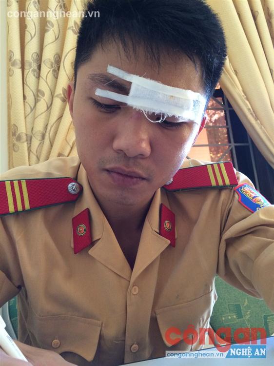 Thượng sỹ Trần Quốc Thịnh bị thương khi đang làm nhiệm vụ