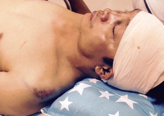  Anh Trần Xuân Hưng đang điều trị tại bệnh viện