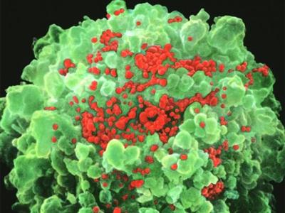 Hình ảnh qua kính hiển vi điện tử của virus HIV