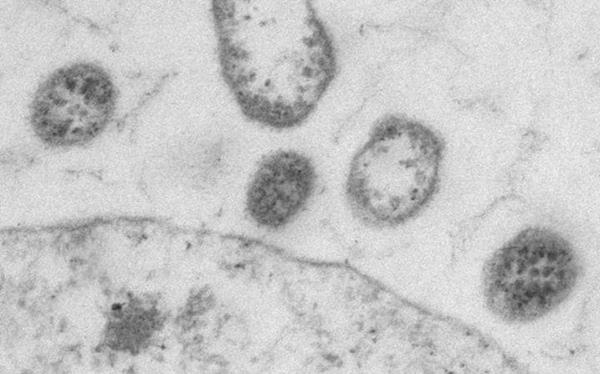 Virus lymphocytic choriomeningitis được cải biến - Ảnh: Doron Merkler.