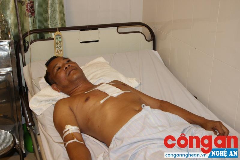  Do bị thương nặng, hiện anh Hội đang phải nằm điều trị tại Bệnh viện Đa khoa 115 Nghệ An