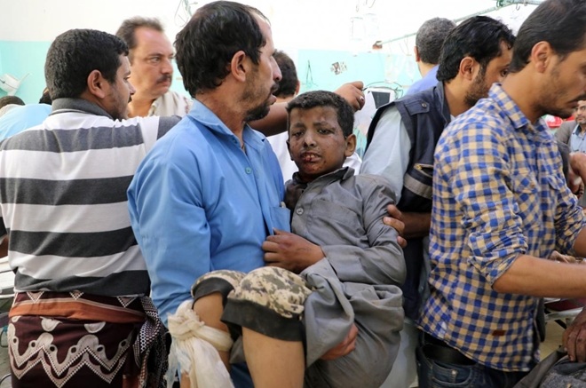Một bé trai bị thương trong vụ không kích. Ảnh: Reuters