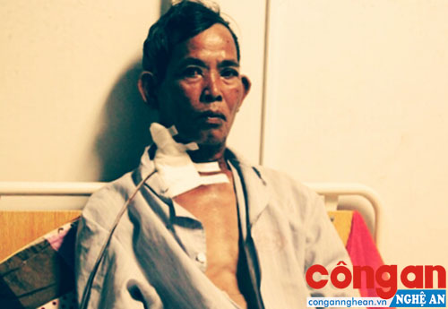 Ông Nguyễn Tường đang điều trị tại Bệnh viện Hữu nghị Đa khoa Nghệ An